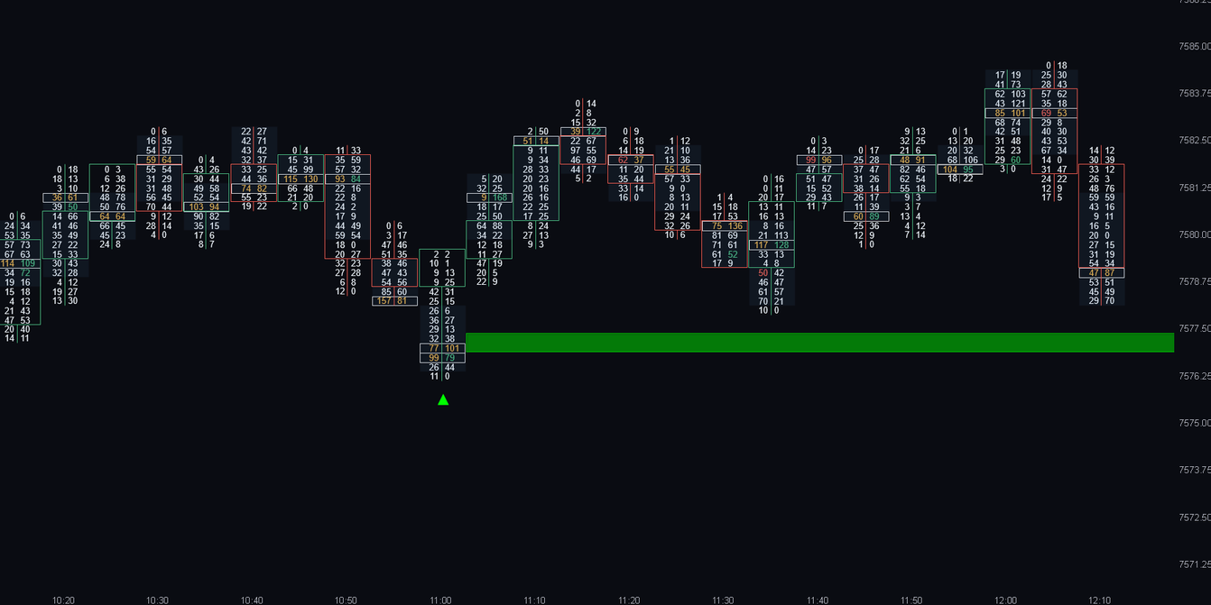 Hammer with Absorption long signal with its absorption zone projected forward, ATAS footprint chart